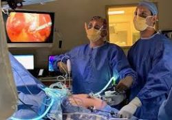 Laparoscopy